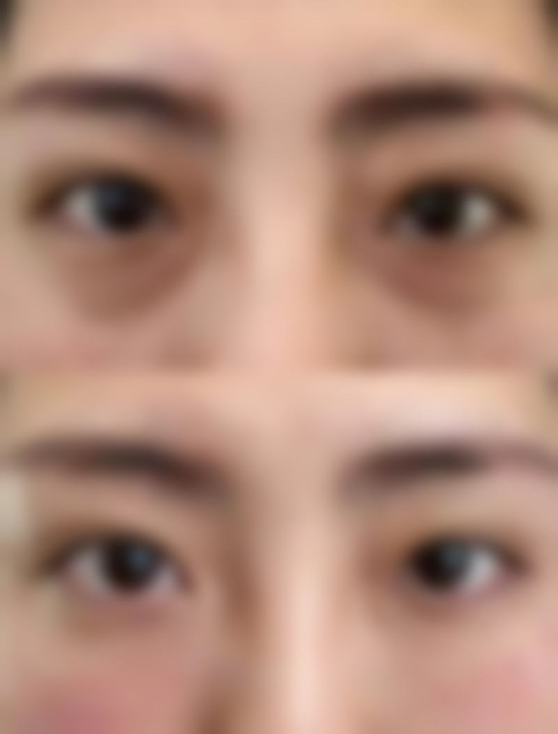 七、特殊体质人群皮肤擦破后的处理