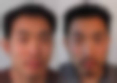 九、昆山青穗新生医疗美容门诊部真实的患者评价