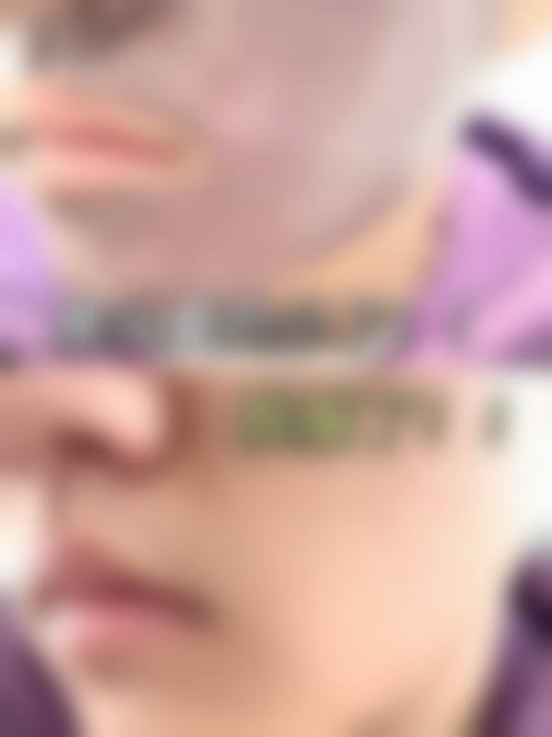 八、黔南州中医院医学美容科真实的患者评价