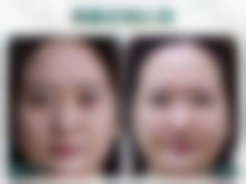 八、郑州健丽整形医院预约方式