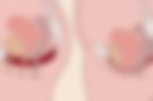 五、一般打瘦脸针打多少单位？其他影响剂量的因素