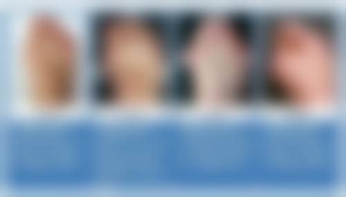 七、正确看待脸型问题