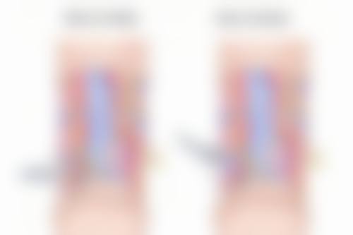 六、其他改善方型脸的方法