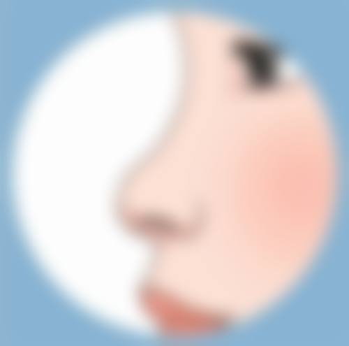 眼袋突然水肿的原因是什么？睡眠、饮食、过敏等因素大揭秘！ 