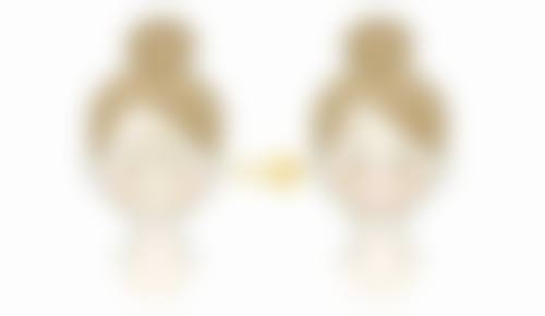 四、眼综合双眼皮手术风险提示