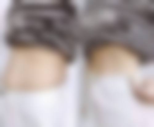 八、大庆立财整形美容医院预约方式