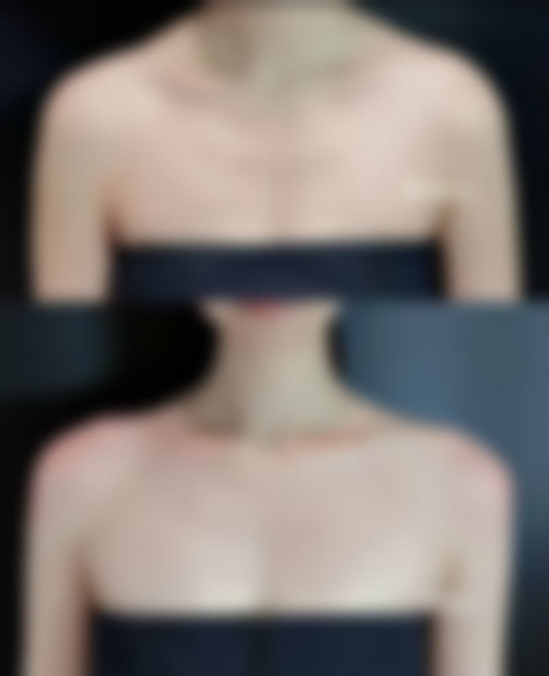 一、方型脸成因大揭秘