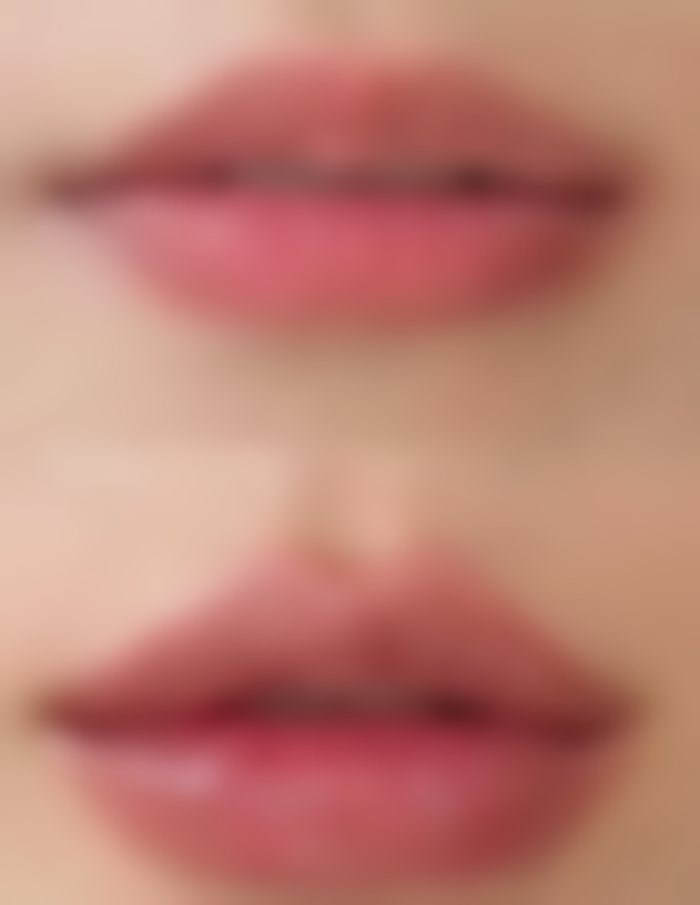 二、瘦脸针的神奇原理