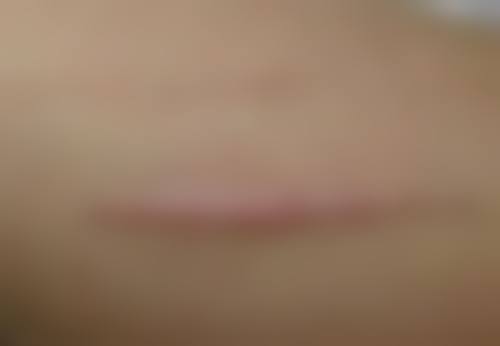 阴道紧缩手术效果好吗？了解手术原理、恢复周期及维持时长，给你准确答案！ 