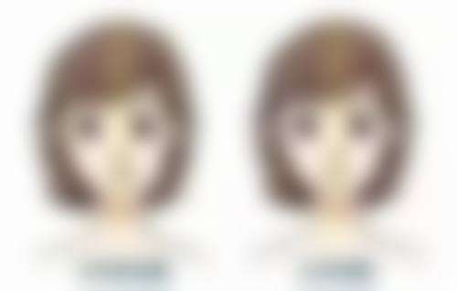 四、阴道紧缩手术成效好吗？维持时长受多因素影响