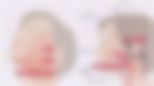 三、割双眼皮修复的具体阶段