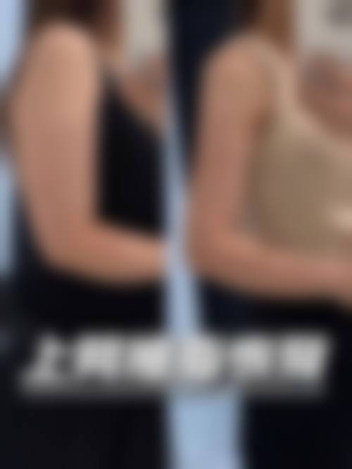 八、安顺赫尔美整形医院真实的患者评价