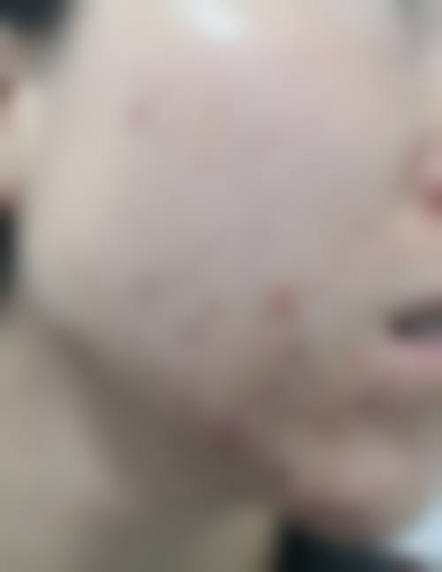 五、李菁园怎么预约？