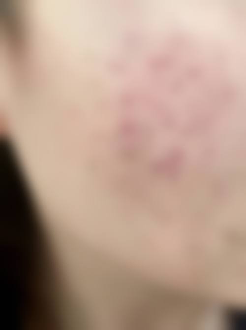 六、李菁园真实的患者评价