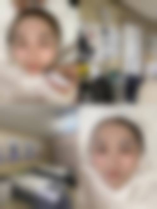 三、黄露技术优势