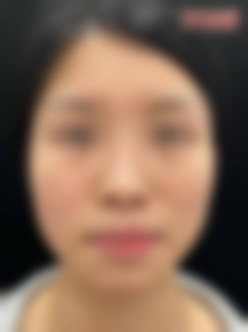 五、安顺赫尔美整形医院价格表