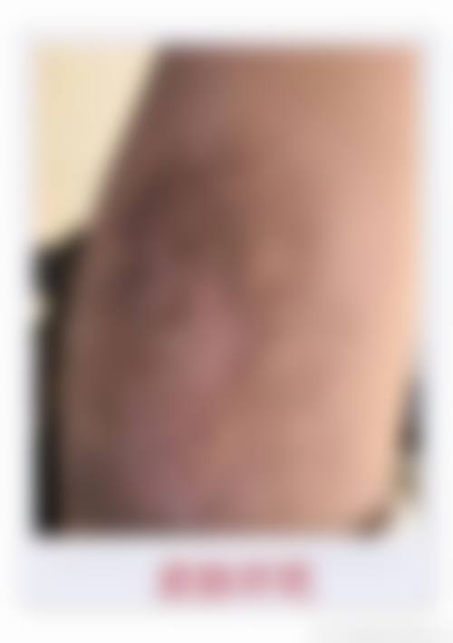 五、台州黄岩皮肤病医院价格表