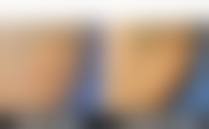 二、安顺赫尔美整形医院怎么样？