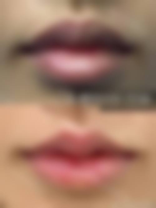 三、湖北黄冈美嘉医疗美容医院诊疗项目有哪些？