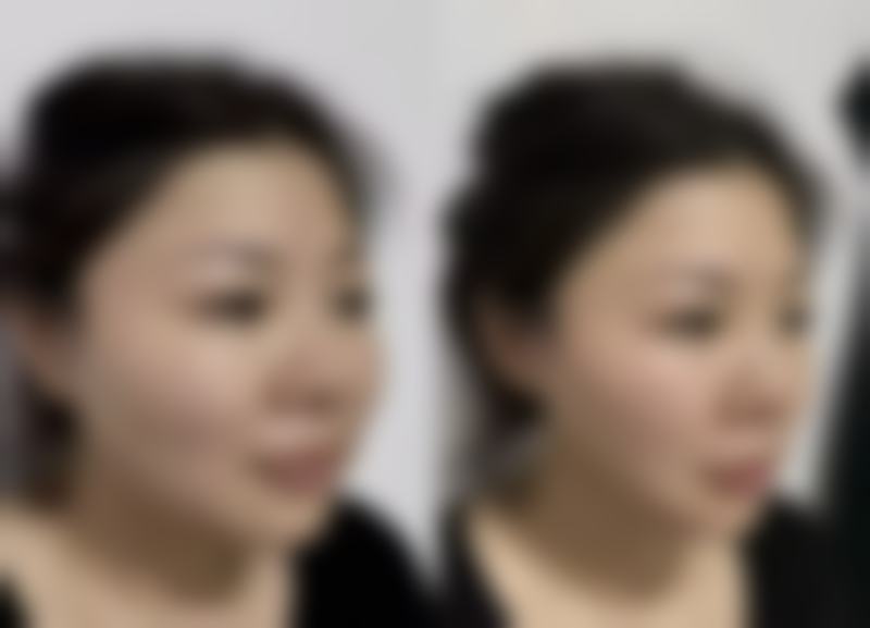 毛发种植是不是真的？科学验证其真实性与优势，效果自然持久值得选择！ 