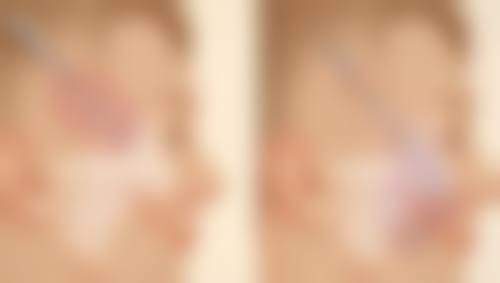 五、治疗注意事项