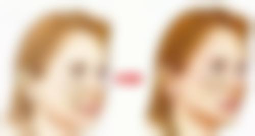 八、疤痕疙瘩包怎么去掉？总结与建议