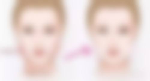 双眼皮手术后多久肉条感可以消失？了解恢复阶段与护理要点，助你早日拥有自然美眼