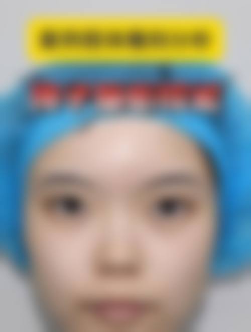 五、俞青怎么预约？