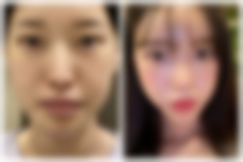 三、广州古汀整形医疗美容诊疗项目有哪些？