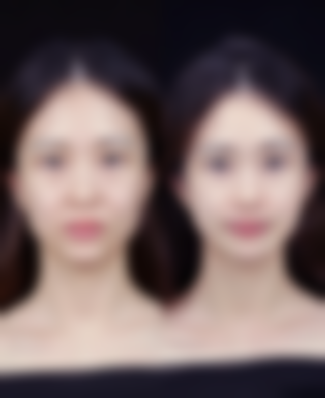 七、治疗实例分享