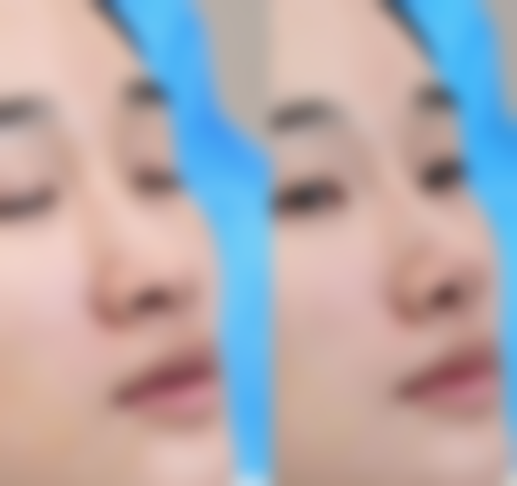 五、广州古汀整形医疗美容价格表