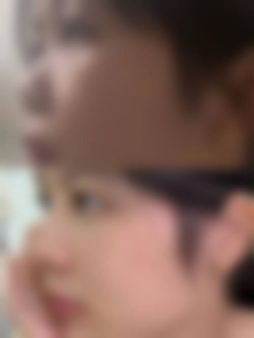 八、三亚爱丽丝医疗美容真实的患者评价