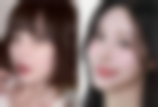 四、中年人去除眼袋的非手术生活调理方法