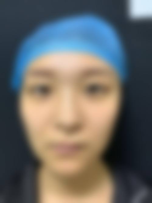 四、兴义时光整形医院特色项目