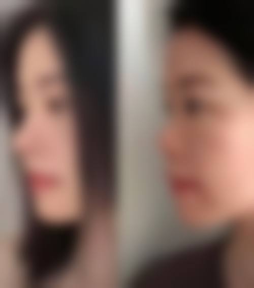 三、孙兰娟技术优势