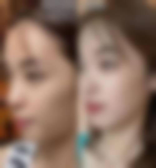 四、西安伊本番茄医疗美容特色项目