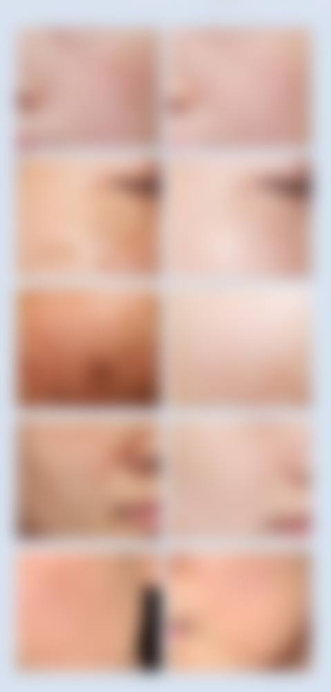 八、鄂州市青春泉医疗美容门诊部真实的患者评价