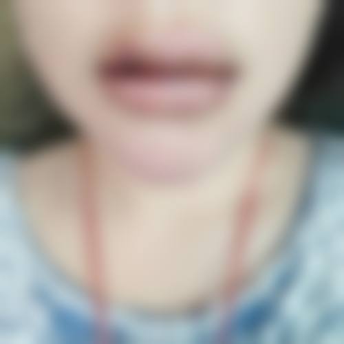 四、鄂州市青春泉医疗美容门诊部特色项目