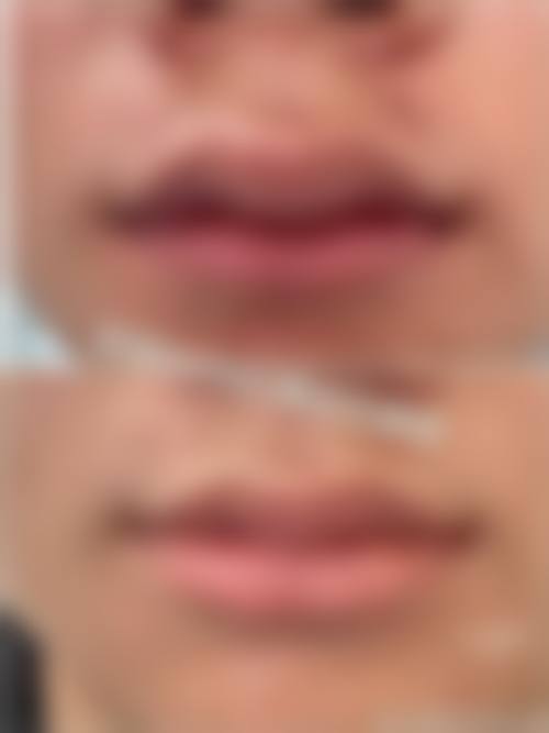 七、鄂州市青春泉医疗美容门诊部预约方式