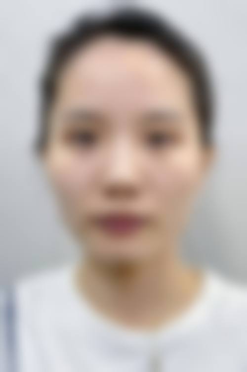 三、鄂州市青春泉医疗美容门诊部诊疗项目有哪些？