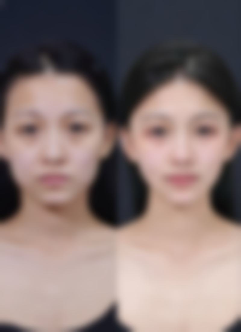 六、伍薇真实的患者评价