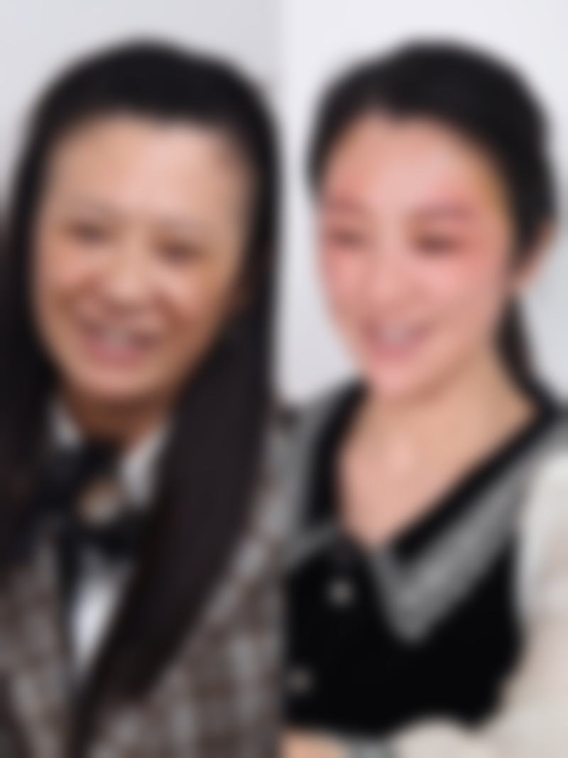 三、做眼袋手术修复的阶段