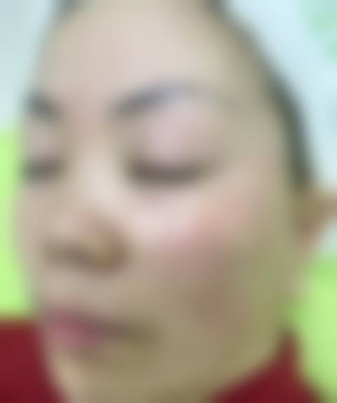 三、成都忠爱整形美容医院诊疗项目有哪些？