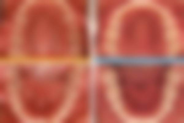 四、柳州托美尔整形医院特色项目