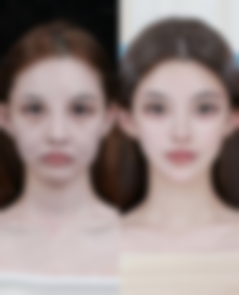 一、脸上打瘦脸针的原理与适用情况揭秘