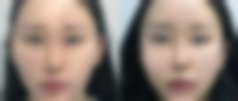 八、惠城美莱医疗美容诊所真实的患者评价