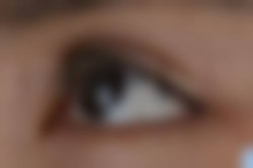 瘦脸针副作用会有哪些？了解常见危害与应对方法，变美更安心！ 