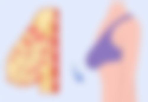 一、缝针后的疤痕类型与评估