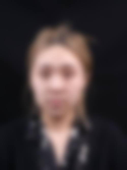 四、南京悦初整形医院特色项目