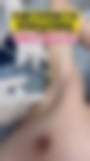 三、深圳首尔丽辰整形美容医院诊疗项目有哪些？